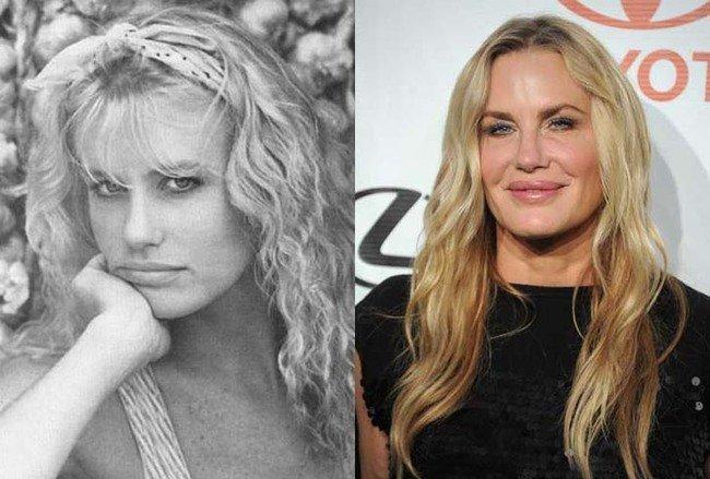 Celebrities-plastic-surgeries-4