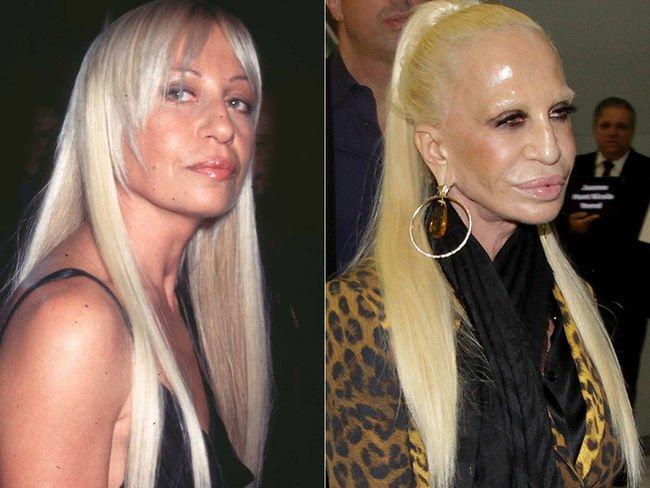 Celebrities-plastic-surgeries-2