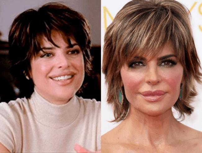 Celebrities-plastic-surgeries-5