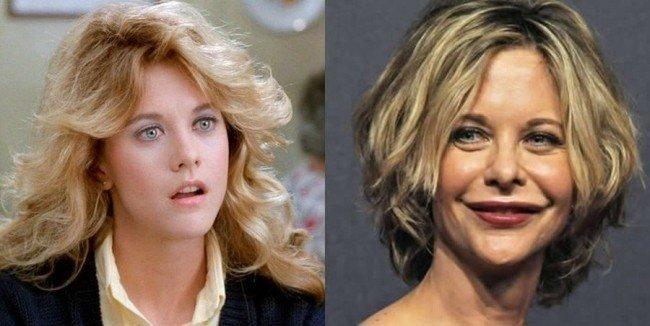 Celebrities-plastic-surgeries-6