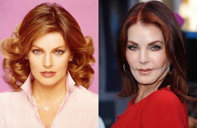 Celebrities-plastic-surgeries-3