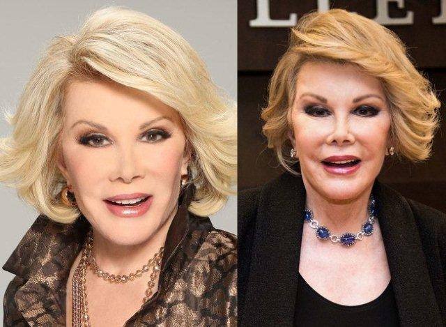 Celebrities-plastic-surgeries-9