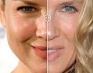 Celebrities-plastic-surgeries-1