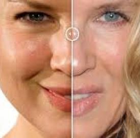 Celebrities-plastic-surgeries-1